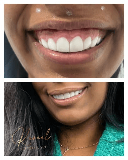 Radiant Smile Transformation